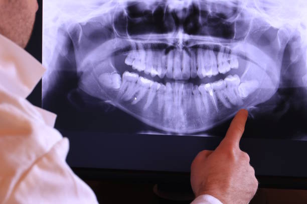 Best Weekend Emergency Dentist in Stevenson, AL
