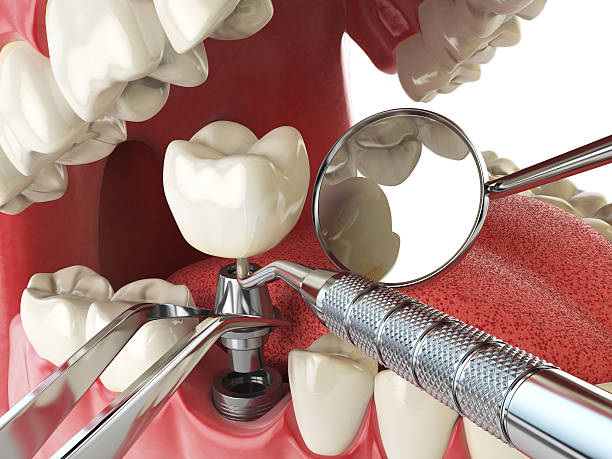 Best Walk-In Emergency Dentist in Stevenson, AL